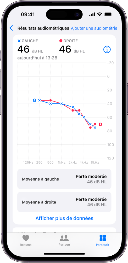 Un audiogramme sur l’iPhone, affichant une perte auditive modérée dans les deux oreilles.