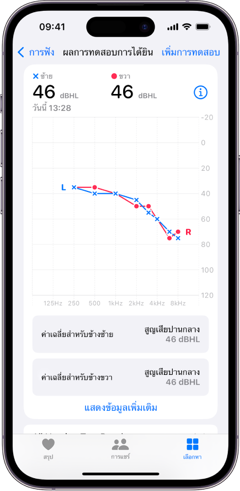 ผลการตรวจการได้ยินบน iPhone ที่แสดงให้เห็นการสูญเสียการได้ยินระดับปานกลางในหูทั้งสองข้าง