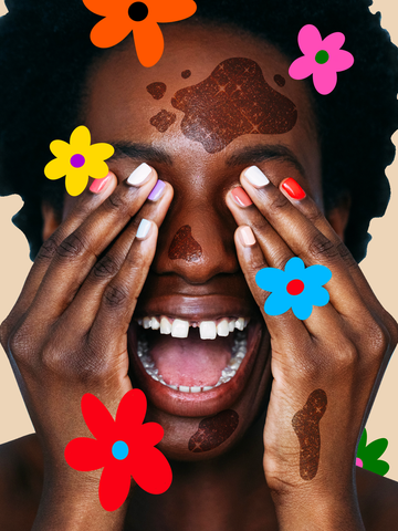 woman with hyperpigmentation surrounded by illustrated flowers