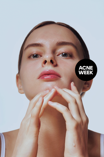 acne face map