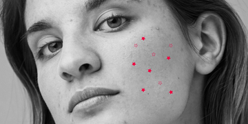 black and white photo of woman with pink star emojis on her face