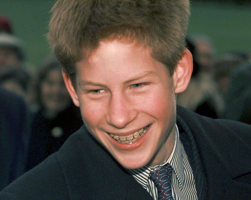 prince harry braces