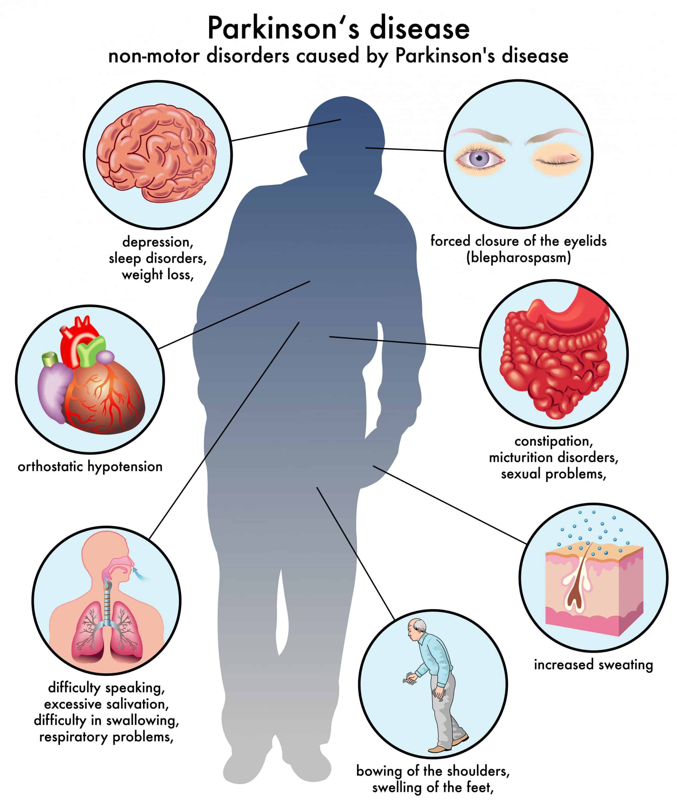 Parkinson‘s Disease