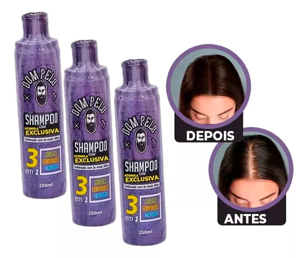 Segunda imagem para pesquisa de minoxidil original