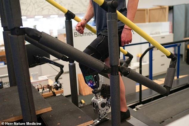 Researchers from MIT have developed a new type of bionic leg which allows patients to control the limb directly with their thoughts