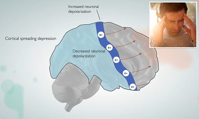 Scientists say they may have FINALLY discovered what causes migraines - and how to put an