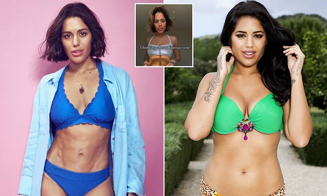 How plastic surgery ruined my body, by Love Island's Malin Andersson: A blue thread was