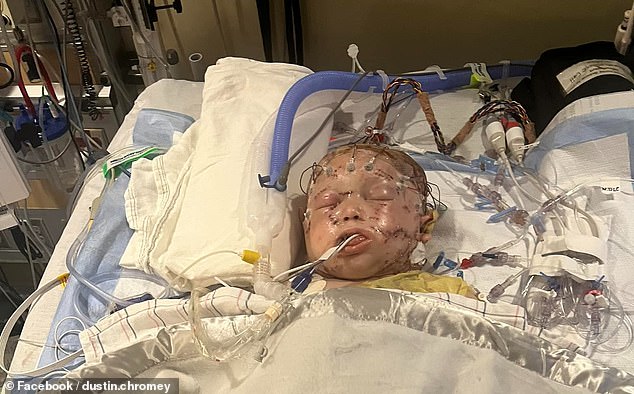 The little boy clung to life for six days in hospital before his death was announced on Thursday