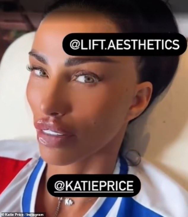 Katie Price showed off the results of her latest cosmetic procedure on Thursday, weeks after travelling to Turkey for her sixth facelift