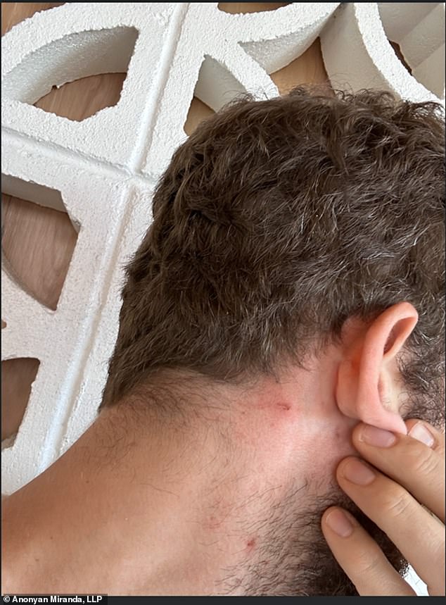 Chigvintsev shows what appears to be a bloody mark behind his ear