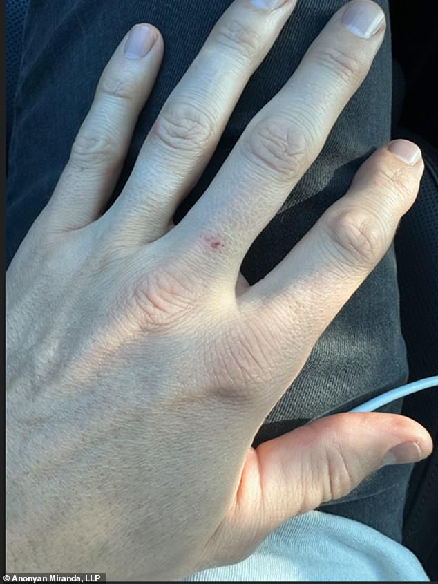 Another photo showed an apparent wound on a finger. He claimed Garcia accused him of 'ruin[ing her] career'