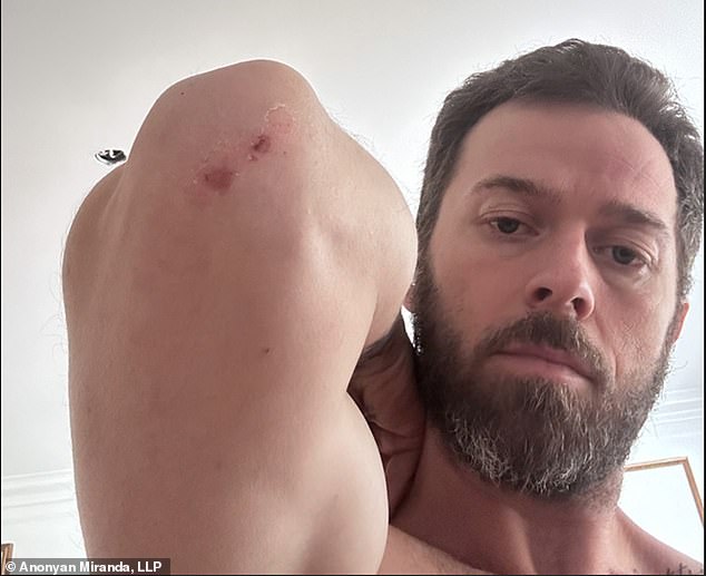 Artem Chigvintsev, 40, is accusing his estranged wife, Nikki Garcia, of domestic violence , one month after she filed to end their two-year marriage. In images submitted to the California Superior Court, Chigvintsev showed marks and bloody scratches on his elbow, and head