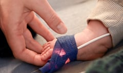 A baby's hand attached to a blood oxygen meter