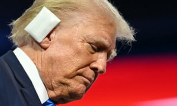 Donald Trump, with his ear in a bandage.