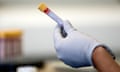 A medical worker wearing a glove holds a test tube containing a blood sample