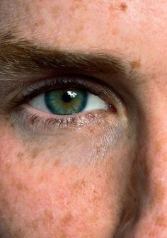 a man with freckles on his face and blue eyes looking at the camera