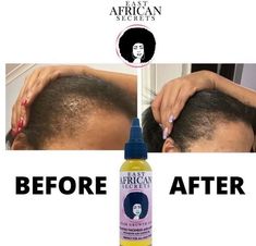 Rapid Hair Growth Oil - East African Secrets Tulsi Tea, Natural Hair Growth Oil, Rapid Hair Growth, Rosemary Sage, Hair Growth Spray, Hair Growth Secrets, Stinging Nettle, Hair Twist Styles, Hair Essentials