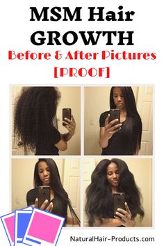 MSM Hair Growth Before and After Pictures [PROOF] biotin rice water diatomaceous earth on natural hair, diy, gel, products, cream, recipe, waves, how to use, cantu, spray care free, best, light weight without shea butter, homemade, without aloe vera. Grow hair faster in a week, long and fast. For African American Women, no castor or coconut oil. These vitamins fill in bald spots.  See healthy tips for thicker hair. NOT an overnight solution. Does not work for certain types of alopecia. How To Use Cantu Products, Tips For Thick Hair, Butter Homemade, Diy Hummus, Natural Hair Diy, Fashion Designer Studio, Fashion Jobs, Bald Spot