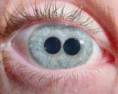 an eye with two black circles on it