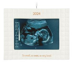 an x - ray photo frame with the words, 2012 so small, so sweet, so very loved