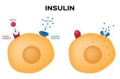 Lipid Profile, Insulin Pump, Blood Glucose Levels, Muscle Tissue, Patient Experience, Insulin Resistance, Important Facts, School Of Medicine, Gain Muscle