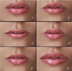 Dermal Fillers Lips, Juvederm Lips, Perfect Nose, Cosmetic Injectables