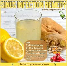 Sinus Sinus Infection Remedy, Natural Sinus Infection Remedy, Sinus Remedies, Sinus Infection Remedies, Allergy Remedies, Natural Healing Remedies, Sinus Infection, Cold Remedies, Homemade Remedies