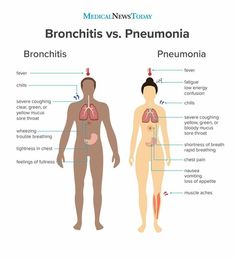 bronchitis vs precumnia info graphic on white background stock photo - premium royalty