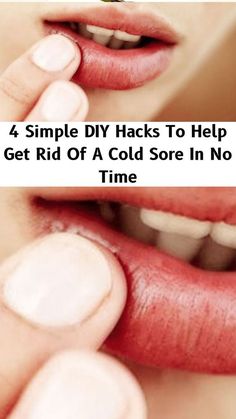 Natural Decongestant Quick Cold Sore Remedy, Cold Sore Remedy Overnight How To Get Rid, Cold Sores Remedies Overnight, How To Get Rid Of Cold Sores, Coldsore Remedies Overnight, Canker Sore Remedy Overnight, How To Get Rid Of Cold Sores Overnight