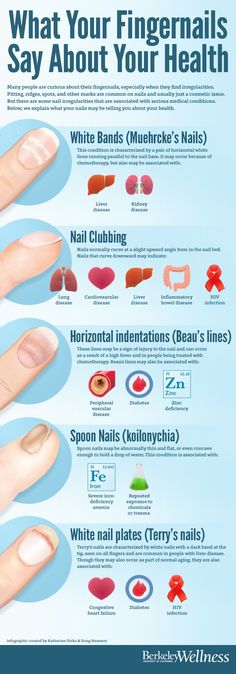 Did you know that some fingernail irregularities are signs of medical conditions? Fingernail Health, Tongue Health, Avocado Smoothie, Mental Training, Nail Health, Health Info, Health Facts, Medical Conditions, Health Remedies