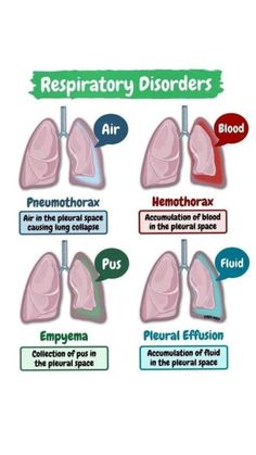 a diagram showing the different types of lungs