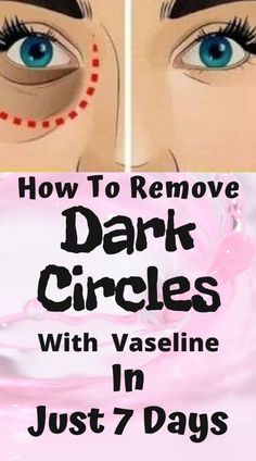 Eye Circle Remedies, Coconut Health, Dark Circle Remedies, Dark Circles Around Eyes, Remove Dark Circles, Skin Care Wrinkles, Eye Circles