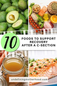 the top ten foods to support recovery after ac - section surgery, including avocado, lemons, and salmon