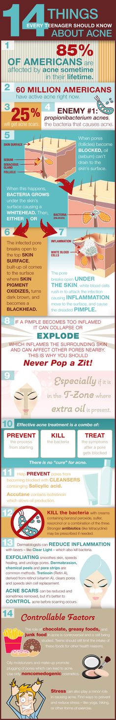 #Acne affects millions of Americans. When it comes to #acne #treatments and acne solutions, there are a number of facts to know about acne and how it affects us. These 14 things you should know about acne will help you to improve and maintain your complexion. Learn the facts of acne treatment and acne prevention. Effaclar Duo, Acne Treatments, Types Of Acne, Acne Problem, Acne Solutions, Acne Free, Acne Remedies, How To Get Rid Of Acne, Prevent Acne