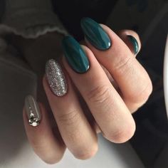 French Pedicure, Dark Green Nails, Fall Nail Trends, Green Nail Designs, Nail Designs Glitter, Beautiful Nail Designs, China Glaze