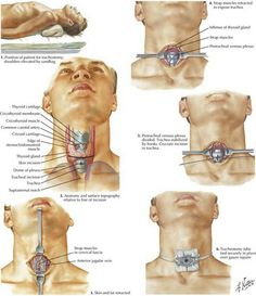 an image of a diagram of the neck and shoulder with instructions on how to use it