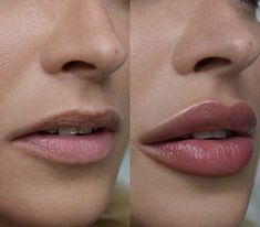 Lips Aesthetic, Lip Permanent Makeup, Lip Filler