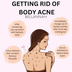 Getting Rid Of Body Acne Get Rid Of Back Acne Fast, Acne On Back How To Get Rid, How To Get Rid Of Body Acne Fast, Different Types Of Acne How To Get Rid, How To Get Rid Of Back Acne Naturally, Things To Get Rid Of Acne, How To Get Rid Of Scars On Face From Acne, How To Get Rid Of Papules On Face, Tips For Back Acne