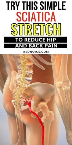 the cover of try this simple sciatica stretch to reduce hip and back pain