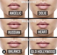 Types Of Lips Shape, Heart Shaped Lips, Lips Inspiration, Lip Types, Face Fillers, Permanente Make-up, Botox Lips, Facial Fillers, Facial Aesthetics