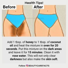 How To Remove Inner Thigh Darkness, How To Remove Private Part Hair, Body Glowing Tips, Private Part Hair Removal, Dark Inner Thighs Remedies, Private Part Lightening, Dark Inner Thighs