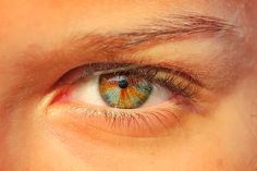 Anatomy Eyes, Sectoral Heterochromia, Eye Color Facts, Lucky Smith, Heterochromia Eyes, Rare Eyes, Different Colored Eyes