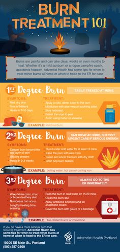 Burn Remedies Hand, Burn Relief Hand, Burn Relief Skin, Burn Wound Care, Burns Nursing, 2nd Degree Burns, Safety Hacks, Burn Remedy, Burn Care