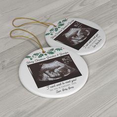 two personalized christmas ornament with an x - ray image