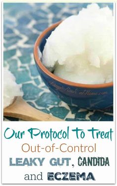 Coconut Oil To Treat Leaky Gut, Candida, [& Surprisingly Diabetes]. Serious help for leaky gut, eczema and serious overgrowth of candida albicans. #recipes #healthy #food #wellness #healthyrecipes #medicine #health #fitness #healing #antiaging #natural #naturalremedies #fitnessaddict #wisdom #faith #kids #coconutoil #mentalhealth #candida #leakygut #antiinflammatory #adhd #gaps Food Wellness, Bad Bugs, Candida Diet Recipes, Candida Cleanse, Candida Overgrowth, Holistic Health Remedies, Candida Albicans, Candida Diet