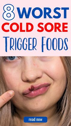 8 Best Strep Throat Self-Care Home Remedies Best Cold Sore Remedy Overnight, Heal Cold Sores Fast, Cold Sore Remedy Overnight, Fever Blister Remedy, Cold Sore Remedy, Blister Remedies, Cold Sore Prevention