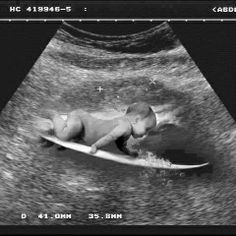 a baby laying on top of a surfboard in the middle of an x - ray