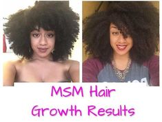 MSM Hair Growth Before and After Pictures  If you want to see MSM hair growth before and after pictures, take a look at MSM natural hair growth results and learn what the best MSM supplements can do for you besides boosting your hair growth.   You’re in the right place.  So you may have asked. Does MSM help grow hair? The answer is yes. Msm For Hair, Hair Growth Regimen, Manifesting Board, Make Hair Grow Faster, Help Hair Growth, Help Hair Grow