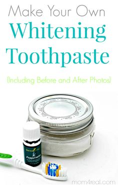 Make-Your-Own-Tooth-Whitening-Paste-with-Before-and-After-Photos-at-Mom-4-Real-Blog Toothpaste Recipe, Tooth Whitening, Pasta Dental, Oil Remedies, Diy Kosmetik, Yl Essential Oils, Living Essentials Oils, Living Essentials, Whitening Toothpaste