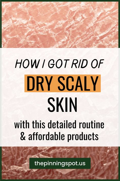 I caused my dry scaly skin trying to get rid of my oily skin. And so to get rid of my dry, scaly skin on face and legs I used this budget-friendly care routine as well as moisturizers to hydrate my skin. These are all the solutions to my dry scaly skin I used, what worked to get rid of my dry scaly skin and what did not work. I hope you find this helpful as you tackle your dry ashy skin. Let's get into it. Skincare Routine For Dry Dull Skin, How To Take Care Of Dry Skin, Skin Care Routine For Very Dry Skin, Get Rid Of Dry Skin On Face, Natural Dry Skin Remedies, Best Dry Skin Products, Skin Care Routine For Sensitive Dry Skin, Scaly Legs Remedy Dry Skin, Flaky Face Skin